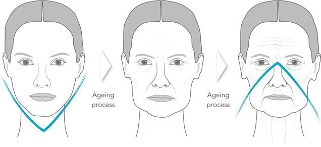 image-v-effect11